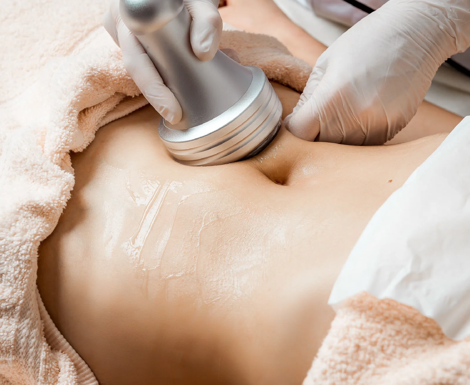 Cavitation and radio frequency body treatment