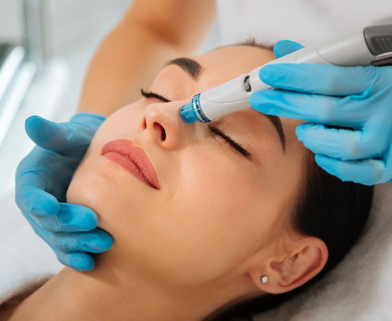 A Hydrofacial treatment in progress